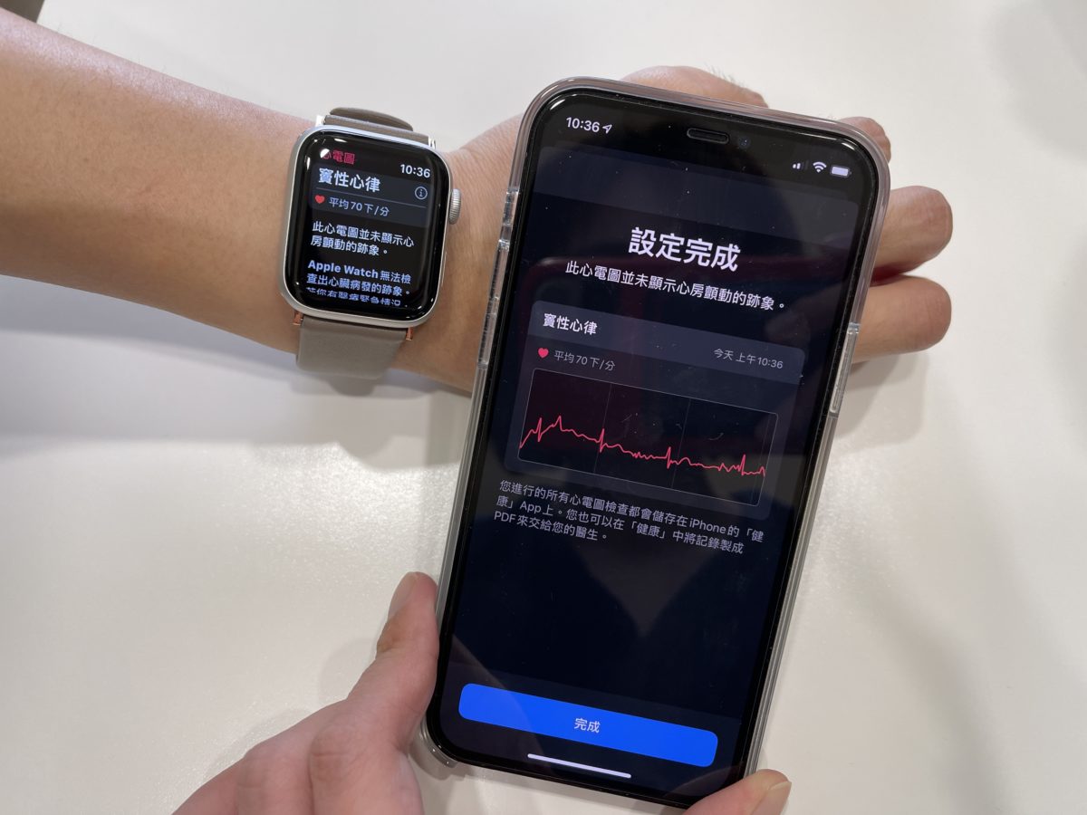 Apple Watch ECG 心電圖