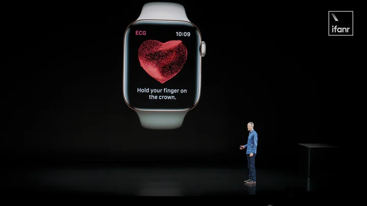 Apple Watch X 更新